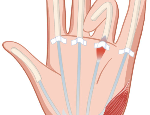 MILLORA DEL TUNEL CARPIÀ